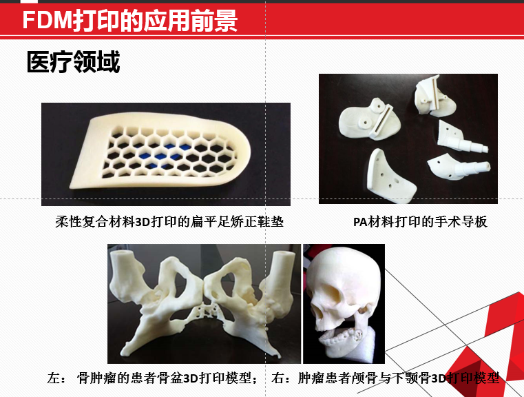 FDM 技術(shù)3D打印機(jī)應(yīng)用領(lǐng)域廣泛，在可預(yù)見的未來無可估量！